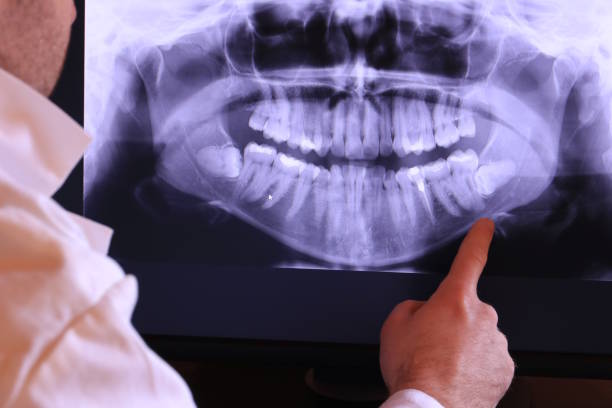 Best Emergency Dental Care for Abscessed Tooth in Moscow, ID