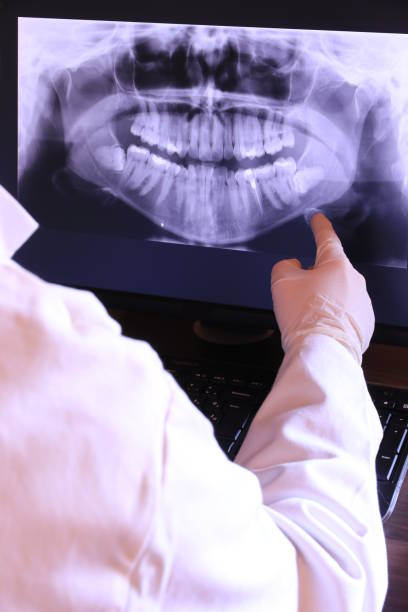 Best Emergency Dental Extractions in Moscow, ID